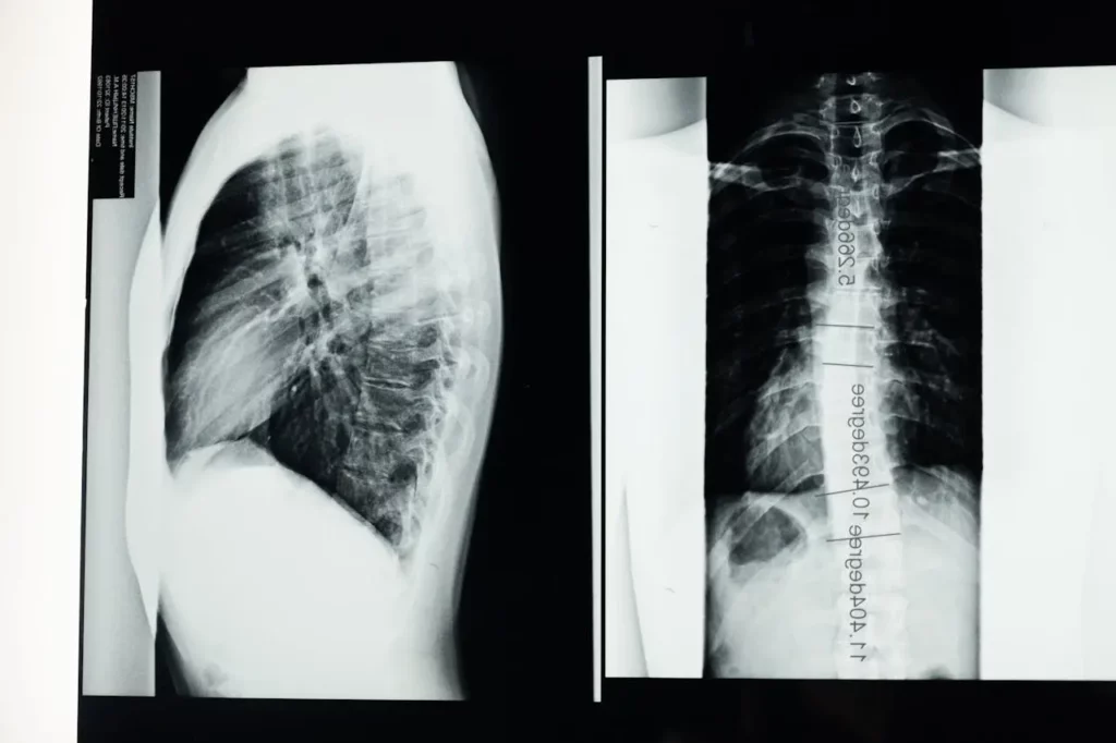 rib image